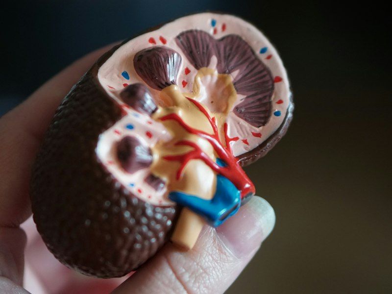 Anatomical model of a human kidney