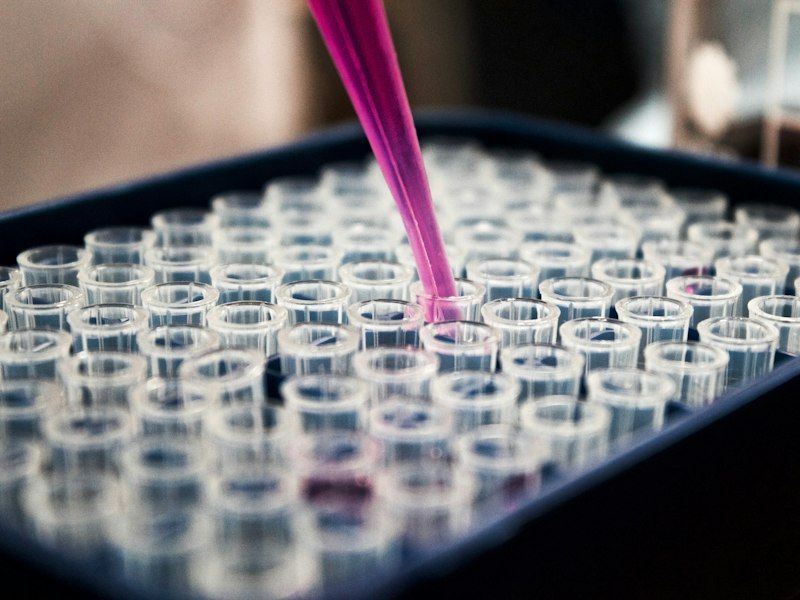 Laboratory sample tubes for kidney function tests